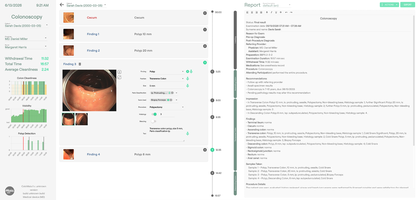 ColoMAIA II colonoscopy reporting interface