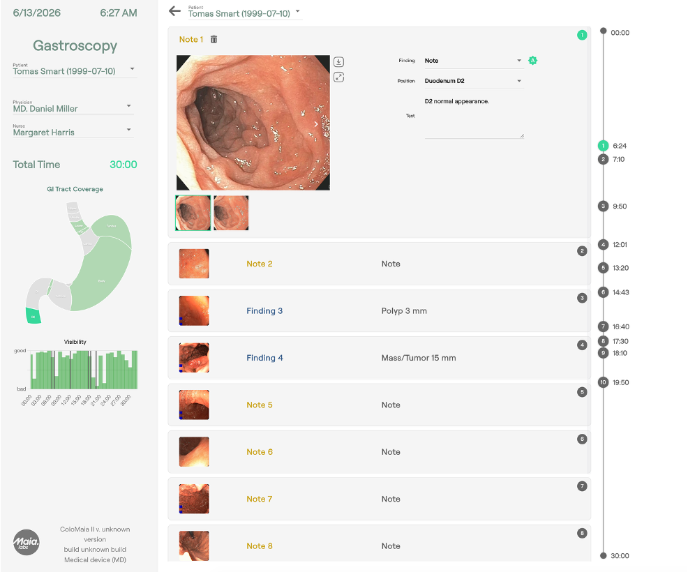 ColoMAIA II gastroscopy reporting interface